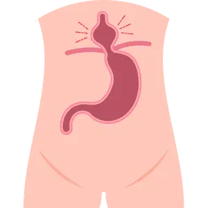 Cirugía de Hernia en Monterrey