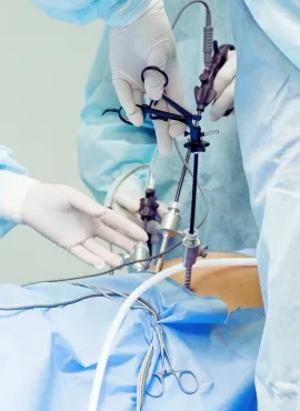 cirugia laparascopica Cirugía de Hernia Inguinal en Monterrey