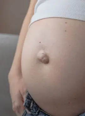 cuando tratar la hernia umbilical Cirugía de Hernia Umbilical en Monterrey