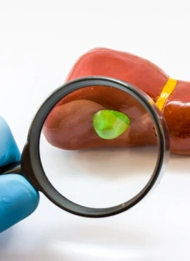 Cirugía de Vesícula en Monterrey